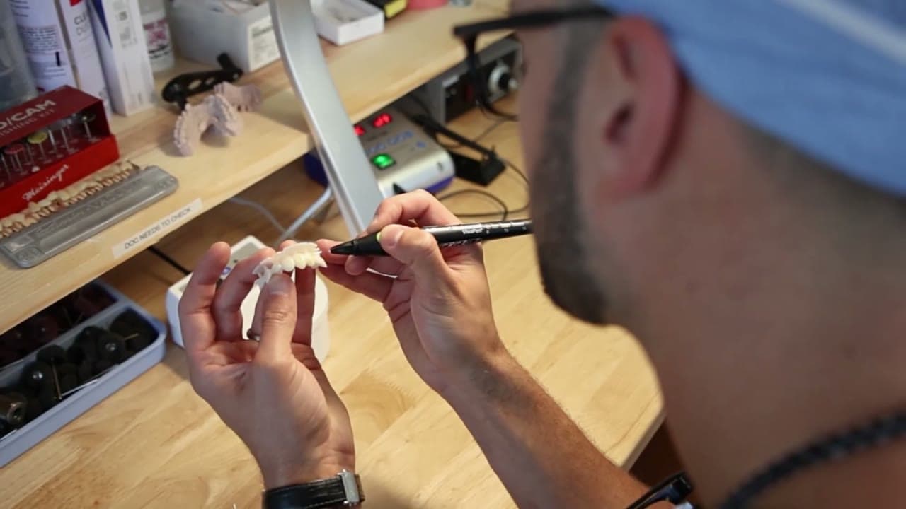 Inside the RealVeneers dental lab