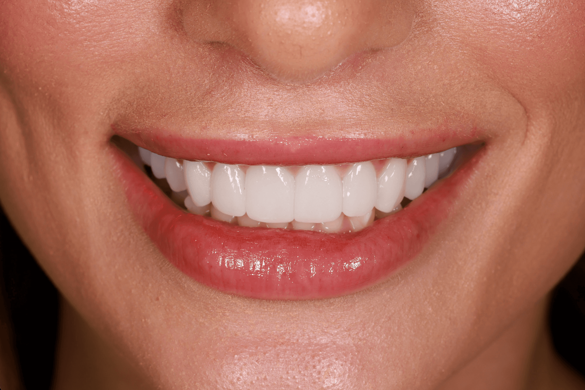 A finished smile after treatment